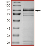 EGFR (D761Y), Active
