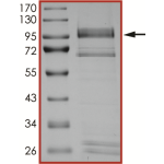 EGFR (L747S), Active