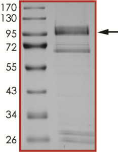 EGFR (L747S), Active
