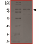 EGFR (G719D), Active
