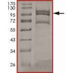 EGFR (d747-749), Active