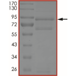 EGFR (L747S), Active
