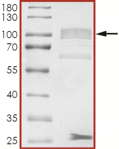 EGFR (D761Y), Active