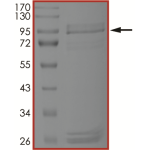 EGFR (A763_Y764insFHEA), Active