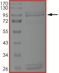 EGFR (A763_Y764insFHEA), Active