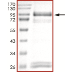 EGFR (D770_N771insNPG), Active