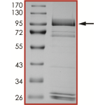 EGFR (D770GY), Active