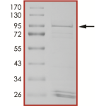 EGFR (H773-V774insAH) Protein