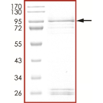 EGFR (P772_H773insPR), Active