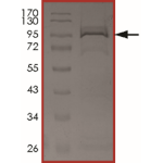 EGFR (A767_S768insTLA) Protein