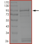 EGFR (P772_H773insNPH), Active