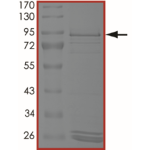 EGFR (H773_V774insNPH) Protein