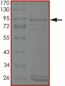 EGFR (H773_V774insNPH) Protein
