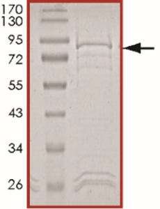 EGFR (H773_V774insAH) Protein