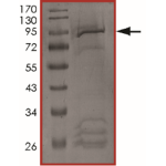 EGFR (H773_V774insPH) Protein