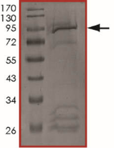 EGFR (H773_V774insPH) Protein