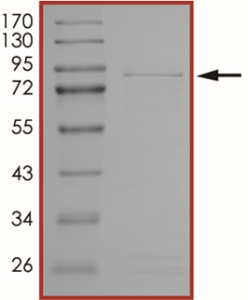EGFR (H773_V774insH) Protein