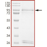 EGFR (V774_C775insHV) Protein