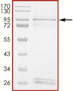 EGFR (V774_C775insHV) Protein