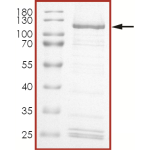 HER2 (E719G) Protein