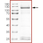 HER2 (E719K) Protein