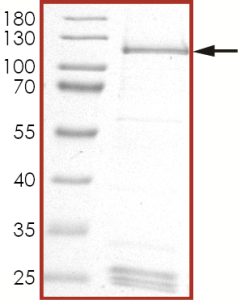 HER2 (L755S) Protein