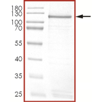 HER2 (D769Y), Active