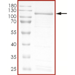 HER2 (R896C), Active