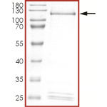 HER2 (I767M), Active
