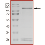 HER2 (T798I), Active