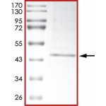 HER2 (V956R), Active