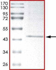 HER2 (V956R), Active
