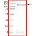 HER2 (G776VC), Active