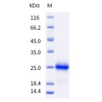 Recombinant Human GITR