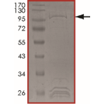 JAK1 (R724H), Active