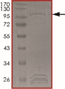 JAK1 (R724H), Active