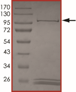 JAK1 (E966V) Protein
