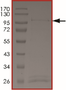 JAK1 (d966-989) Protein