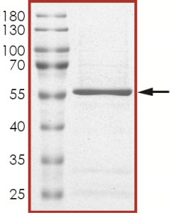 JAK1 (JH2 domain) Protein