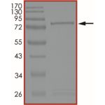 MET (D1228V), Active