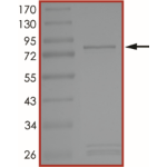 MET (D1228Y), Active
