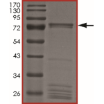 MET (T1173I), Active