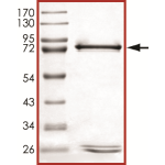 MET (D1228N), Active