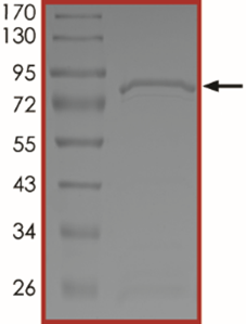 MET (Y1230C), Active