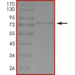 MET (K1244R), Active