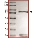 MET (L1195V), Active