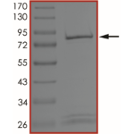 MET (H1094Y), Active