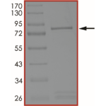 MET (G1163R), Active