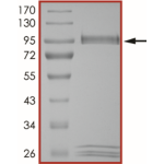 PAK2 (Y443N), Active