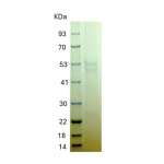 Recombinant Human PD-1